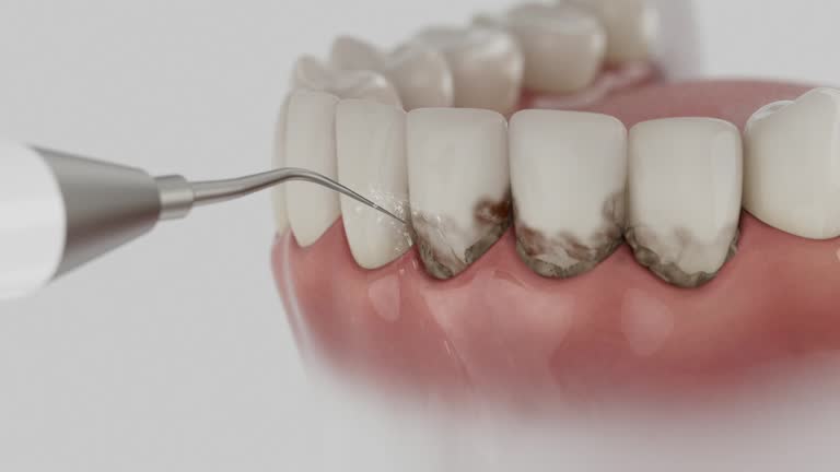 Trusted Dental Implants service in San Juan, TX - Dentist Open Now